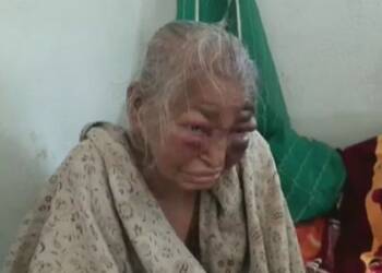 TMC के ताबूत में आखिरी कील- TMC गुंडों के हाथों बेरहमी से पीटी गईं 85 वर्षीय शोभा माज़ूमदार का निधन