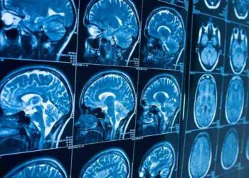 कॉलेज, फीस, योग्यता और सलैरी, रेडिओलॉजी कोर्स से जुड़ी सम्पूर्ण जानकारी हिंदी में