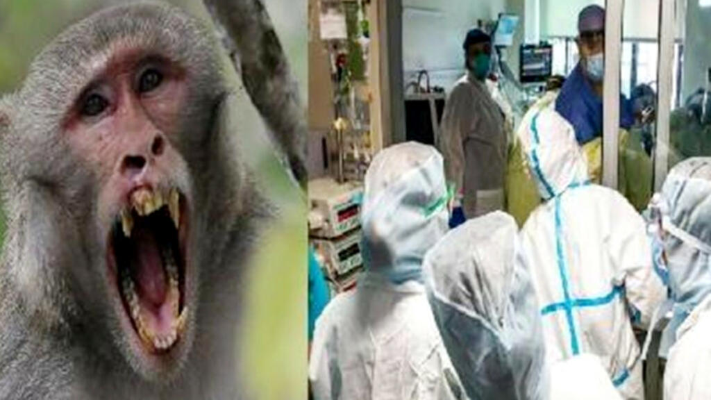 monkey pox Virus