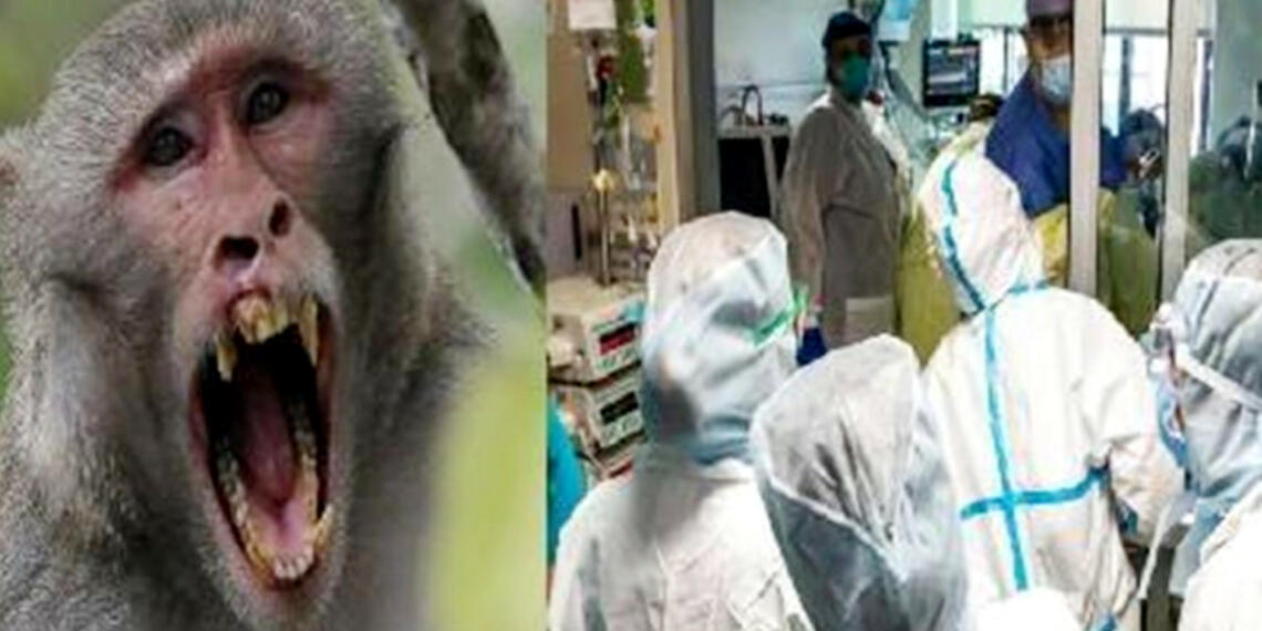 monkey pox Virus