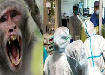 monkey pox Virus