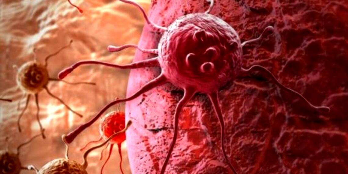 कैंसर का इलाज