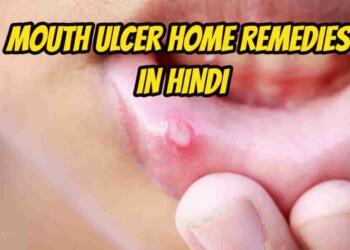 Ulcer  meaning in hindi