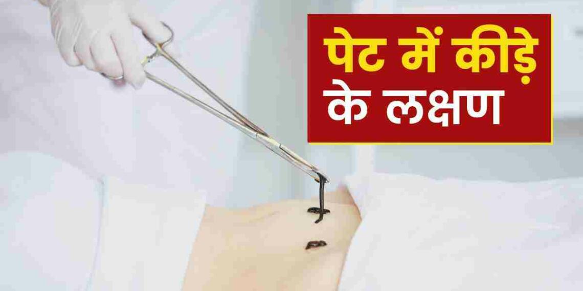 Pet me Kide Hone ke Lakshan