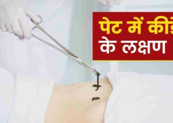 Pet me Kide Hone ke Lakshan