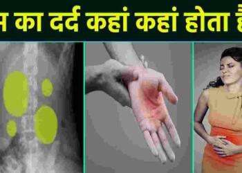 Gas ka Dard kahan hota hai