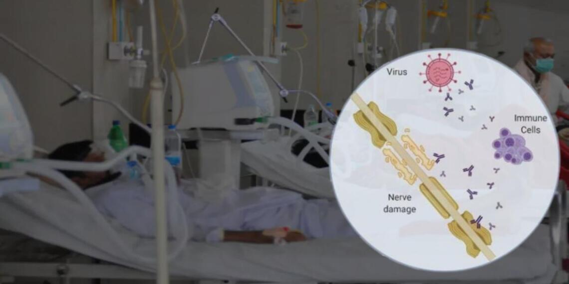महाराष्ट्र में गुइलेन बैरे सिंड्रोम का कहर, तीसरी मौत हुई दर्ज व वेंटिलेटर पर 20 मरीज़; जानें कैसे करें बचाव?