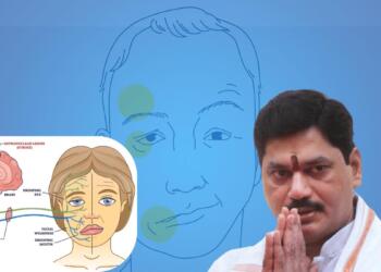 इस बीमारी में चेहरे की एक तरफ की मांसपेशियों में अचानक कमज़ोरी आ जाती है या लकवे जैसी स्थिति हो जाती है