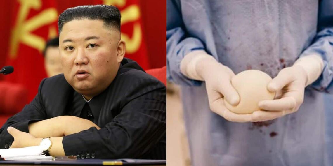 उत्तर कोरिया ने कॉस्मेटिक सर्जरी पर लगाई रोक: भारत को भी उत्तर कोरिया से सीख लेनी चाहिए