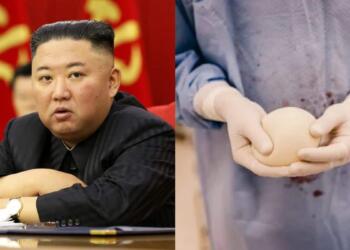 उत्तर कोरिया ने कॉस्मेटिक सर्जरी पर लगाई रोक: भारत को भी उत्तर कोरिया से सीख लेनी चाहिए