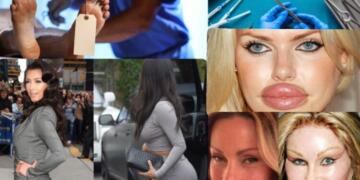 अमेरिका भर में AlloClae नामक एक नया और विवादास्पद कॉस्मेटिक ट्रेंड तेज़ी से चर्चा में है